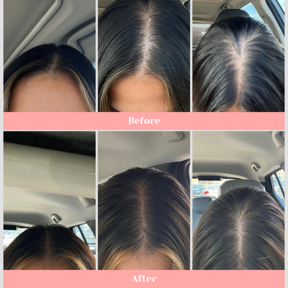 LUSHAIR™  Premium Hair Growth Brush