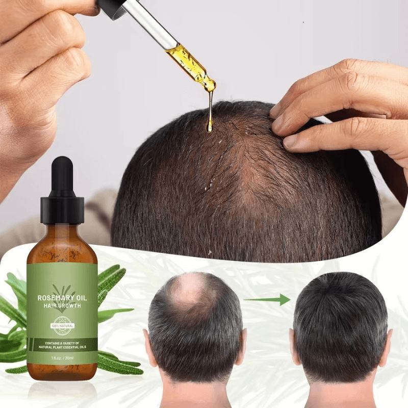 Rosemary Essential Oil